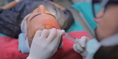 Hair transplant Turkey cost