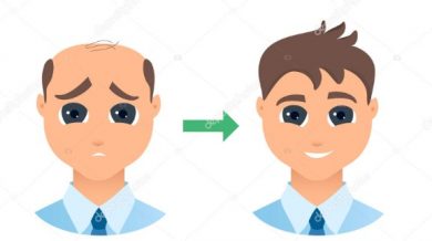 hair transplant in Turkey package