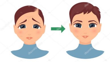 hair transplant in Turkey package