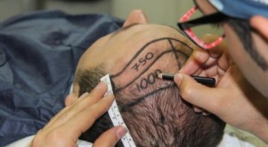 fue-hair