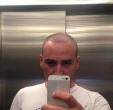 hair fall treatment (2)