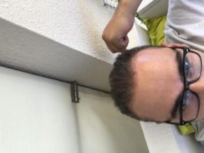 hair loss treatment for men (3)