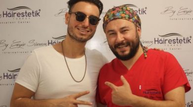 hair-transplant-Faydee