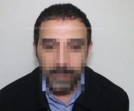 hair transplant in turkey by doctor (7)