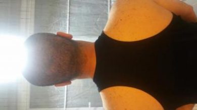 hair transplant reviews (5)