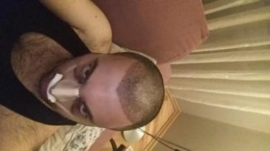 hair transplant reviews (6)