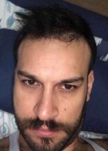 hair transplant turkey antalya (15)