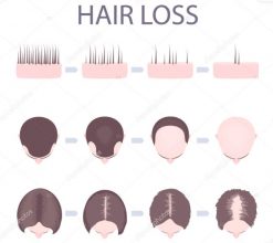 hair-loss-treatment