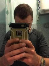 best hair transplant in istanbul (1)