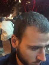 best hair transplant in istanbul (20)