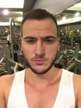 best hair transplant in istanbul (21)
