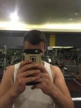 best hair transplant in istanbul (22)