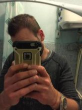 best hair transplant in istanbul (25)