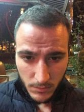 best hair transplant in istanbul (8)
