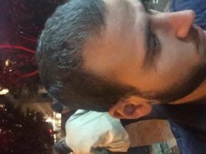 best hair transplant in istanbul (9)