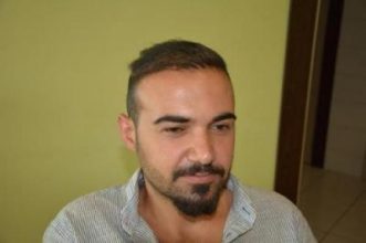 best-hair-transplant-in-turkey (11)
