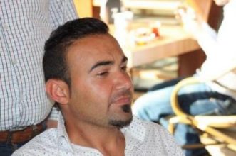 best-hair-transplant-in-turkey (12)