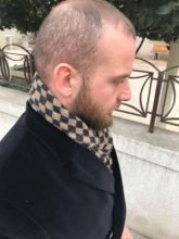 best-hair-transplant-turkey (10)