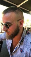 best-hair-transplant-turkey (16)