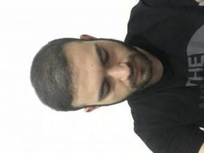 fue-hair-transplant-turkey (6)