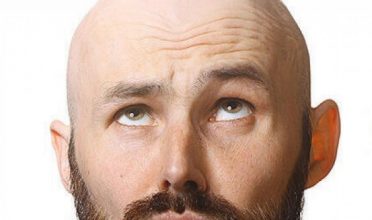 hair-surgery-by-doctor-turkey