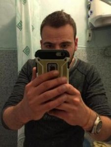 hair transplant cost