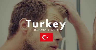 hair transplant turkey