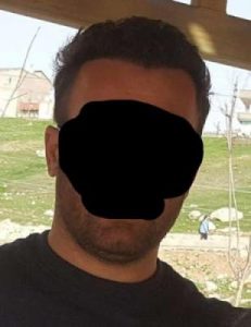 hair transplant turkey costs (14)