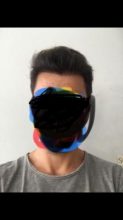 hair-transplant-turkey-istanbul (3)