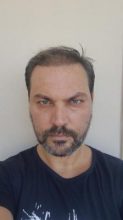 esteworld-istanbul-clinic-turkey (20)
