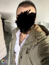 hair-transplant-cost-turkey (21)