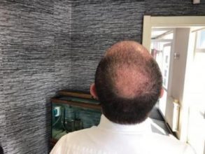 best-ht-in-turkey (10)