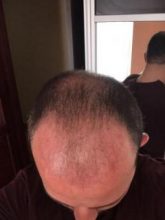 best-ht-in-turkey (11)