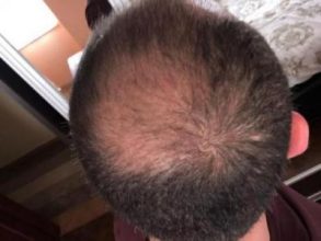 best-ht-in-turkey (12)