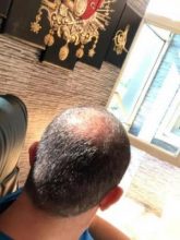 best-ht-in-turkey (13)