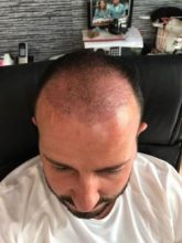 best-ht-in-turkey (14)