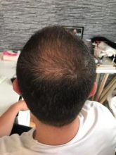 best-ht-in-turkey (15)