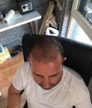 best-ht-in-turkey (16)