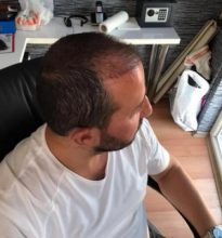 best-ht-in-turkey (17)