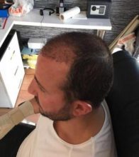 best-ht-in-turkey (18)