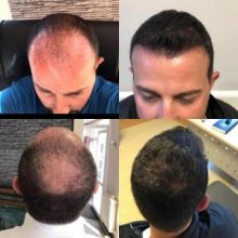 best-ht-in-turkey (5)