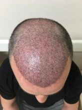 best-ht-in-turkey (9)