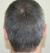 dr-keser-two-operations (1)