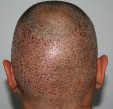 dr-keser-two-operations (10)