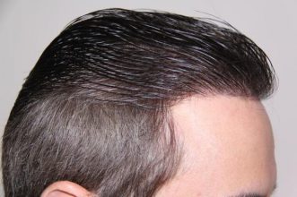 dr-keser-two-operations (11)