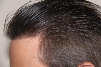 dr-keser-two-operations (12)