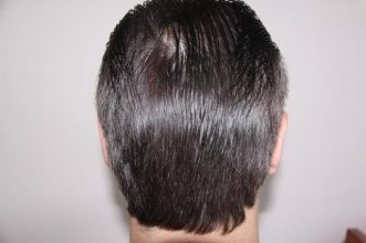 dr-keser-two-operations (13)