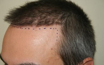 dr-keser-two-operations (15)