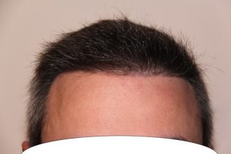 dr-keser-two-operations (2)