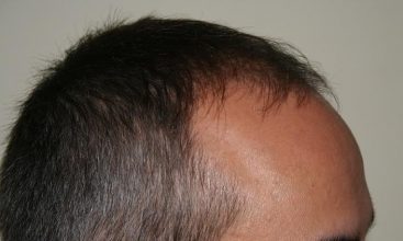 dr-keser-two-operations (3)